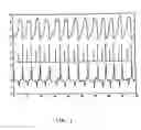 Fig. 02 - Method and apparatus for detecting the respiratory activity of a person