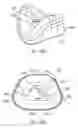 Fig. 35 - Ergonomic and adjustable respiratory mask assembly with frame