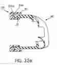 Fig. 50 - Ergonomic and adjustable respiratory mask assembly with frame