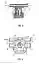 Fig. 03 - Middle ear pressure equalizing device with improved pressure control