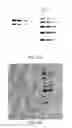 Fig. 09 - Electro-blotting devices, systems, and kits, and methods for their use