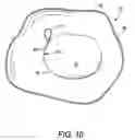 Fig. 06 - Pressure point materials storage, mixing, and delivery system
