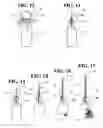 Fig. 08 - Pressure point materials storage, mixing, and delivery system