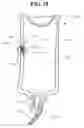 Fig. 10 - Pressure point materials storage, mixing, and delivery system