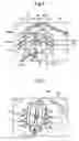 Fig. 05 - Thin plate supporting container