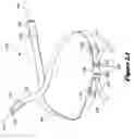 Fig. 02 - Strapping system