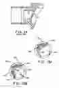Fig. 07 - Rotary irrigation sprinkler nozzle