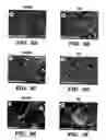 Fig. 09 - Silk fibroin materials and use thereof