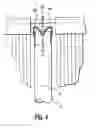 Fig. 05 - Flexible fence assembly