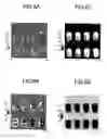 Fig. 06 - Semiconductor device having die attachment and die pad for applying tensile or compressive stress to the IC chip