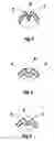 Fig. 03 - Bellows for articulated joints