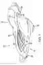 Fig. 02 - Snow sled having steerable foot rudders