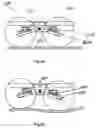 Fig. 12 - Suspension system for a vehicle