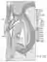 Fig. 23 - TUBE FITTING WITH FERRULE HAVING RECESS