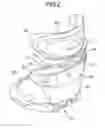 Fig. 03 - Child seat, ventilation portion structure of article and cover of article comprising the ventilation portion structure, and article for child