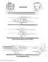 Fig. 04 - Barnes & Barnes Neck Reliever