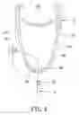 Fig. 05 - Bicycle wheel rim