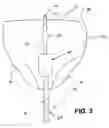 Fig. 03 - Ultrasonic transducer