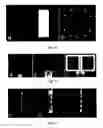 Fig. 04 - Magnetic resonance imaging having radiation compatible radiofrequency coils