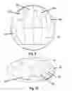 Fig. 07 - WHOLE HAND COMPUTER MOUSE WITH A BUTTON FOR EACH FINGER