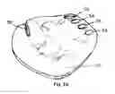 Fig. 10 - WHOLE HAND COMPUTER MOUSE WITH A BUTTON FOR EACH FINGER