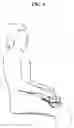 Fig. 04 - Ergonomic keyboard systems and methods