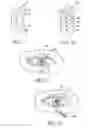 Fig. 08 - Mask configured to maintain nutrient transport without producing visible diffraction patterns