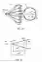 Fig. 12 - Mask configured to maintain nutrient transport without producing visible diffraction patterns