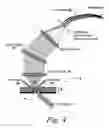 Fig. 04 - Optical detector for a particle sorting system
