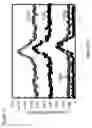 Fig. 14 - Single-photon generator