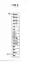 Fig. 03 - LAN signal transmitting method and apparatus adapted to shut down a LAN signal if extracted link information indicates link down