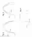 Fig. 04 - Location of focal plane