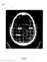 Fig. 04 - Inverse planning using optimization constraints derived from image intensity