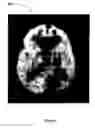 Fig. 05 - Inverse planning using optimization constraints derived from image intensity