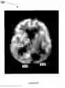 Fig. 07 - Inverse planning using optimization constraints derived from image intensity