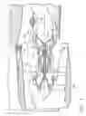 Fig. 02 - Forward tilted turbine nozzle