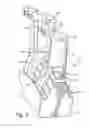 Fig. 02 - Methods and systems for assembling shrouded turbine bucket and tangential entry dovetail