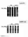 Fig. 02 - Surface protein of 