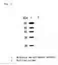 Fig. 04 - Flavin protein of trypanosoma cruzi, method of screening vermicide with the use of the same and diagnostic