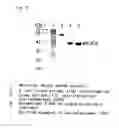 Fig. 07 - Flavin protein of trypanosoma cruzi, method of screening vermicide with the use of the same and diagnostic