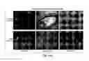 Fig. 43 - Drug-eluting intravascular prostheses and methods of use