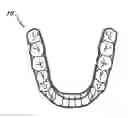Fig. 01 - Orthodontic appliance with embedded wire for moving teeth and method