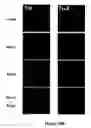 Fig. 50 - Modified human embryonic stem cells and methods of use to treat neuron-associated disorders