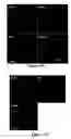 Fig. 55 - Modified human embryonic stem cells and methods of use to treat neuron-associated disorders