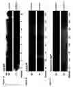 Fig. 02 - Novel steroid 5alpha-reductase