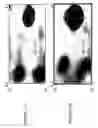 Fig. 20 - Focused microarray and methods of diagnosing chemotherapeutic drug resistance in a cancer cell
