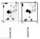 Fig. 26 - Focused microarray and methods of diagnosing chemotherapeutic drug resistance in a cancer cell