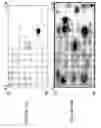Fig. 41 - Focused microarray and methods of diagnosing chemotherapeutic drug resistance in a cancer cell