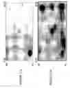 Fig. 43 - Focused microarray and methods of diagnosing chemotherapeutic drug resistance in a cancer cell