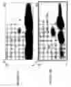 Fig. 44 - Focused microarray and methods of diagnosing chemotherapeutic drug resistance in a cancer cell